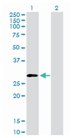 proteasome (prosome, macropain) 26S subunit, non-ATPase, 9, Rabbit, Purified