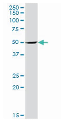 prostaglandin-endoperoxide synthase 1 (prostaglandin G/H synthase and cyclooxygenase), Rabbit, Purified MaxPab Polyclonal Antibody, Abnova 100 &mu;g | Buy Online | Abnova Corporation | Fisher Scientific