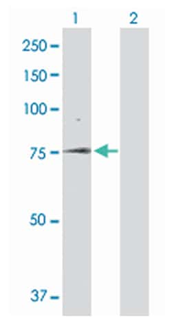 solute carrier family 5 (sodium/glucose cotransporter), member 1, Rabbit,