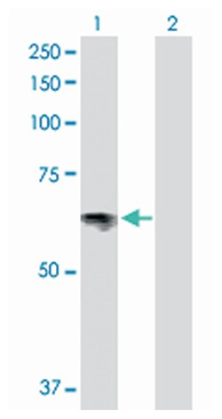 solute carrier family 6 (neurotransmitter transporter, serotonin), member