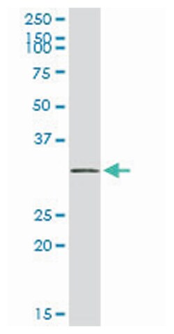 small nuclear ribonucleoprotein polypeptide A, Rabbit, Purified MaxPab