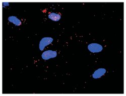 signal transducer and activator of transcription 5A, Rabbit, Purified MaxPab