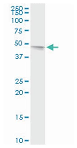 TAF7 RNA polymerase II, TATA box binding protein (TBP)-associated factor,