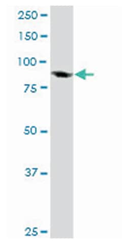 transcription elongation factor B (SIII), polypeptide 3 (110kDa, elongin