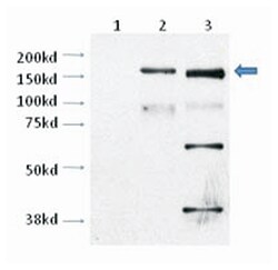 TRPM2 Polyclonal Antibody, Invitrogen 100 &mu;L; Unconjugated:Antibodies,