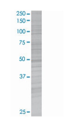 CHRNA4 293T Cell Overexpression Lysate (Denatured), Abnova 100 &mu;L | Buy Online | Abnova | Fisher Scientific
