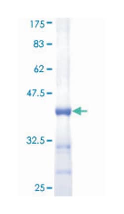 Abnova SHH (Human) Recombinant Protein (Q01) 10 &mu;g | Buy Online | Abnova&trade; | Fisher Scientific