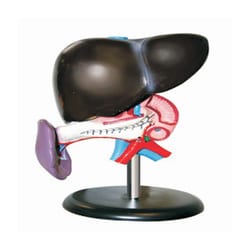Walter Products&trade;&nbsp;Enlarged Liver Model