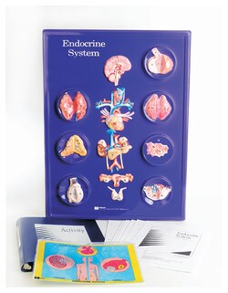 American Educational Products Endocrine System Model Activity Set Endocrine