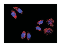 anti-ACTN4, CTNNB1 Protein Protein Interaction Antibody Pair, Abnova 1