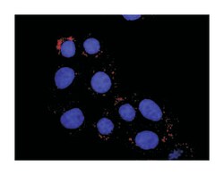 anti-FYN, CTNNB1 Protein Protein Interaction Antibody Pair, Abnova 1 Set,