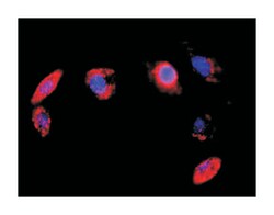 anti-RPS6KA5, RELA Protein Protein Interaction Antibody Pair, Abnova 1 Set | Buy Online | Abnova Corporation | Fisher Scientific
