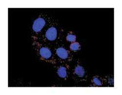anti-RPS6KA5, RELA Protein Protein Interaction Antibody Pair, Abnova 1 Set | Buy Online | Abnova Corporation | Fisher Scientific