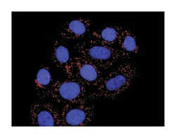 anti-HDAC2, RELA Protein Protein Interaction Antibody Pair, Abnova 1 Set,