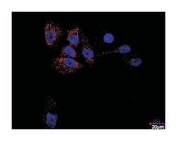 anti-HDAC2, RELA Protein Protein Interaction Antibody Pair, Abnova 1 Set,