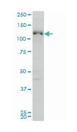 ABL2, Mouse, Clone: 6D5, Abnova 100&mu;g; Unlabeled:Antibodies, Monoclonal