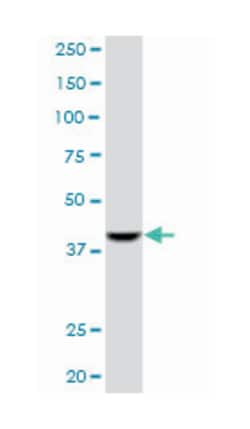 ACAA1, Mouse, Clone: 3F11, Abnova 100&mu;g; Unlabeled:Antibodies, Monoclonal
