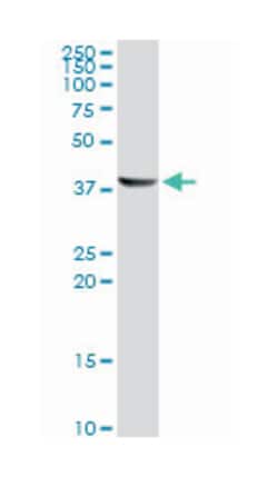 ACAA1, Mouse, Clone: 3F11, Abnova 100&mu;g; Unlabeled:Antibodies, Monoclonal