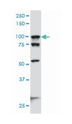 ACTN4 (M01), Mouse anti-Human, Mouse, Rat, Clone: 4D10, Abnova&trade;