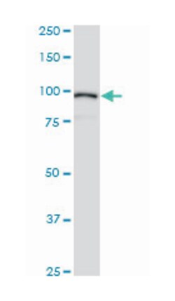 ACTN4 (M01), Mouse anti-Human, Mouse, Rat, Clone: 4D10, Abnova&trade;