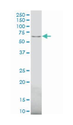 activin A receptor, type IIB, Mouse, Polyclonal Antibody, Abnova 50&mu;L;