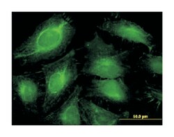 ABCF1, Mouse, Clone: 1B4, Abnova 100&mu;g; Unlabeled:Antibodies, Monoclonal