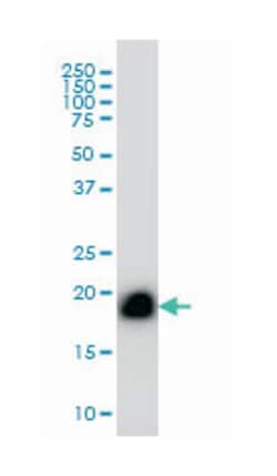 RHOA, Mouse, Clone: 1C10, Abnova 100&mu;g; Unlabeled:Antibodies, Monoclonal