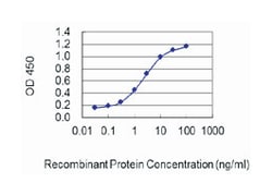 CYP7A1, Mouse, Clone: 8F1, Abnova 100 &mu;g | Buy Online | Abnova | Fisher Scientific