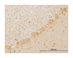 LIMK1, Mouse, Clone: 2E9, Abnova 100 &mu;g | Buy Online | Abnova Corporation | Fisher Scientific