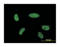ATOH1, Mouse, Clone: 3B12, Abnova™