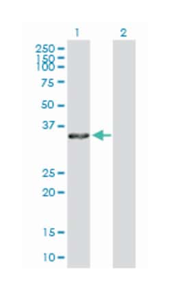 annexin A4, Rabbit, Purified MaxPab Polyclonal Antibody, Abnova 100&mu;g;