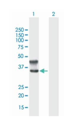 CD1D, Mouse, Polyclonal Antibody, Abnova 50 &mu;L | Buy Online | Abnova Corporation | Fisher Scientific