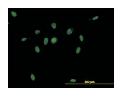 CSE1 chromosome segregation 1-like (yeast), Mouse, Clone: 2C10, Abnova 100 &mu;g | Buy Online | Abnova Corporation | Fisher Scientific