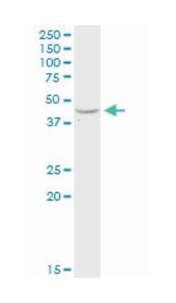 adenosine deaminase, Rabbit, Purified MaxPab Polyclonal Antibody, Abnova 100 &mu;g | Buy Online | Abnova | Fisher Scientific