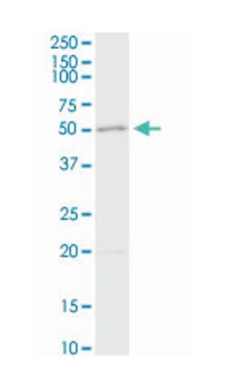 adenosine deaminase, Rabbit, Purified MaxPab Polyclonal Antibody, Abnova 100 &mu;g | Buy Online | Abnova | Fisher Scientific