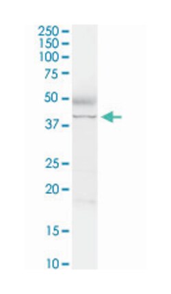adenosine deaminase, Rabbit, Purified MaxPab Polyclonal Antibody, Abnova 100 &mu;g | Buy Online | Abnova | Fisher Scientific