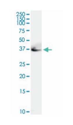 adenosine deaminase, Rabbit, Purified MaxPab Polyclonal Antibody, Abnova 100 &mu;g | Buy Online | Abnova | Fisher Scientific