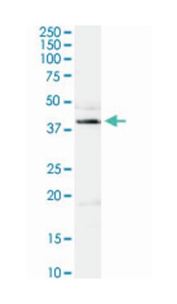 adenosine deaminase, Rabbit, Purified MaxPab Polyclonal Antibody, Abnova 100 &mu;g | Buy Online | Abnova | Fisher Scientific