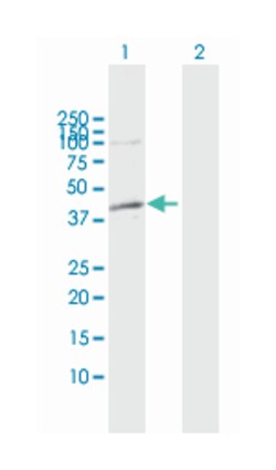 ADH1C, Rabbit, MaxPab Polyclonal Antibody, Abnova 100&mu;L; Unlabeled:Antibodies,