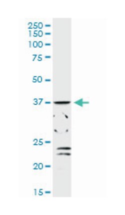 ADH1C, Rabbit, MaxPab Polyclonal Antibody, Abnova 100&mu;L; Unlabeled:Antibodies,