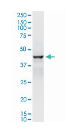 ADH1C, Rabbit, MaxPab Polyclonal Antibody, Abnova 100&mu;L; Unlabeled:Antibodies,