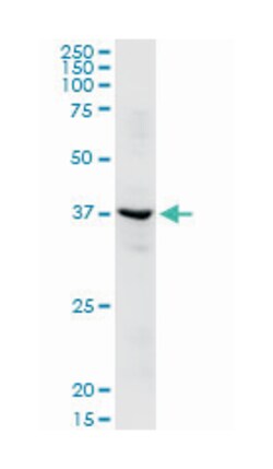 ADH1C, Rabbit, Purified MaxPab Polyclonal Antibody, Abnova 100&mu;g; Unlabeled:Anticuerpos