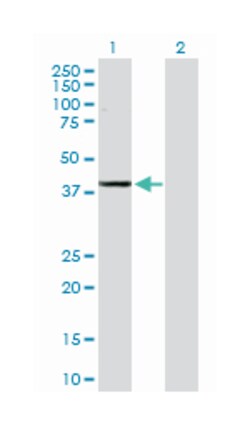 ADH1C, Rabbit, Purified MaxPab Polyclonal Antibody, Abnova 100&mu;g; Unlabeled:Anticuerpos