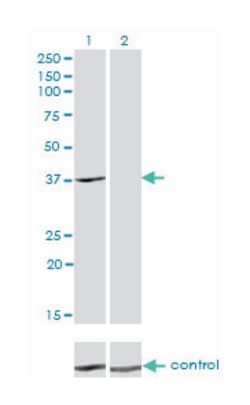 ADH4, Mouse, Clone: 3C5, Abnova 100&mu;g; Unlabeled:Antibodies, Monoclonal