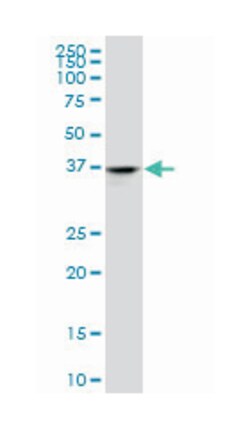 ADH4, Mouse, Clone: 1D2, Abnova 200&mu;L; Unlabeled:Antibodies, Monoclonal