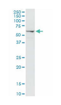 advanced glycosylation end product-specific receptor, Rabbit, Purified MaxPab Polyclonal Antibody, Abnova 100 &mu;g | Buy Online | Abnova | Fisher Scientific