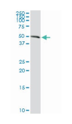 advanced glycosylation end product-specific receptor, Rabbit, Purified MaxPab Polyclonal Antibody, Abnova 100 &mu;g | Buy Online | Abnova | Fisher Scientific