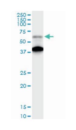 advanced glycosylation end product-specific receptor, Rabbit, Purified MaxPab Polyclonal Antibody, Abnova 100 &mu;g | Buy Online | Abnova | Fisher Scientific