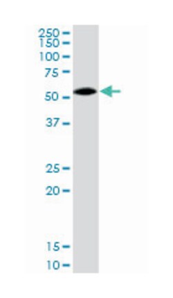 alpha-2-HS-glycoprotein, Rabbit, Purified MaxPab Polyclonal Antibody, Abnova
