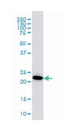 adenylate kinase 1, Mouse, Clone: M1, Abnova™